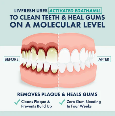 LIVFRESH Gel Toothpaste